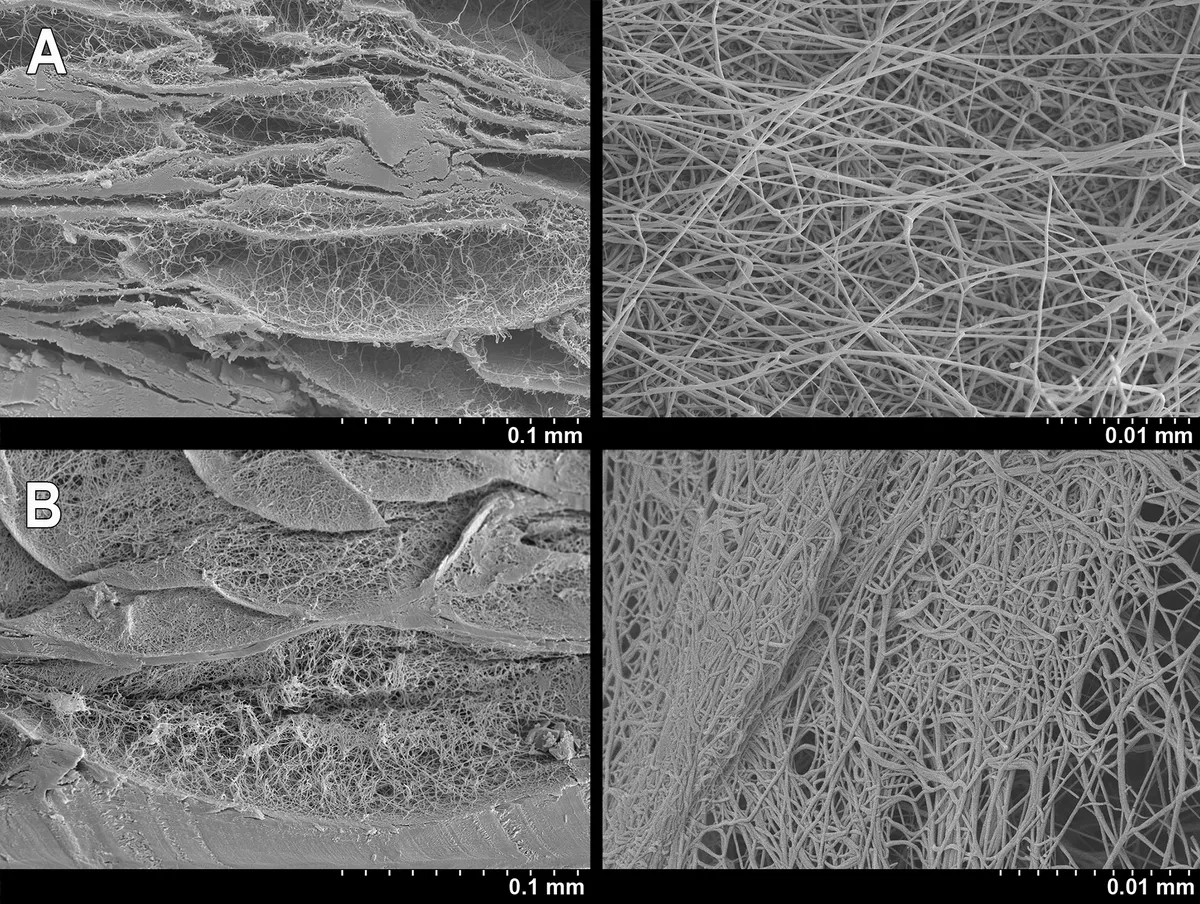 Coral Gorgonia Phyllosclera