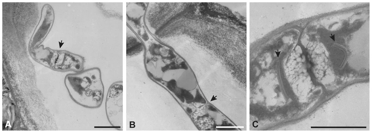 Serendipita herbamans